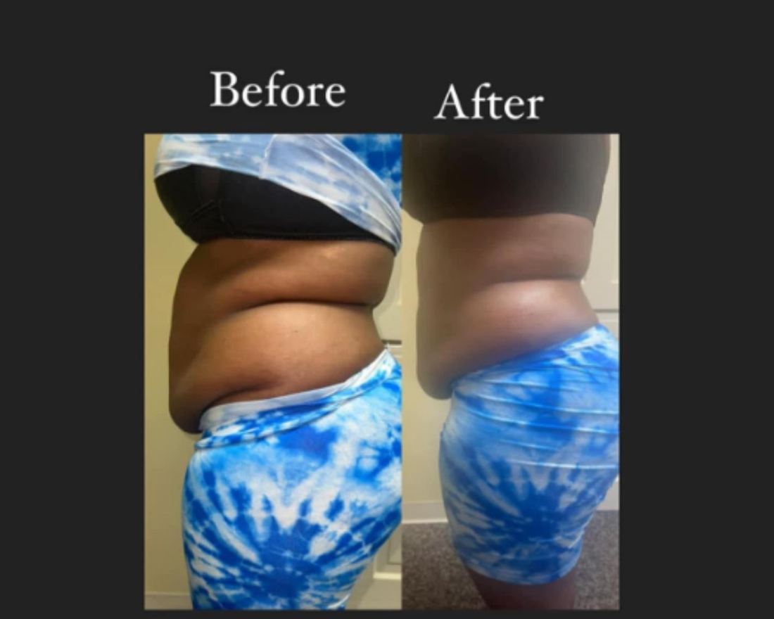 Fine China Body Sculpting website image