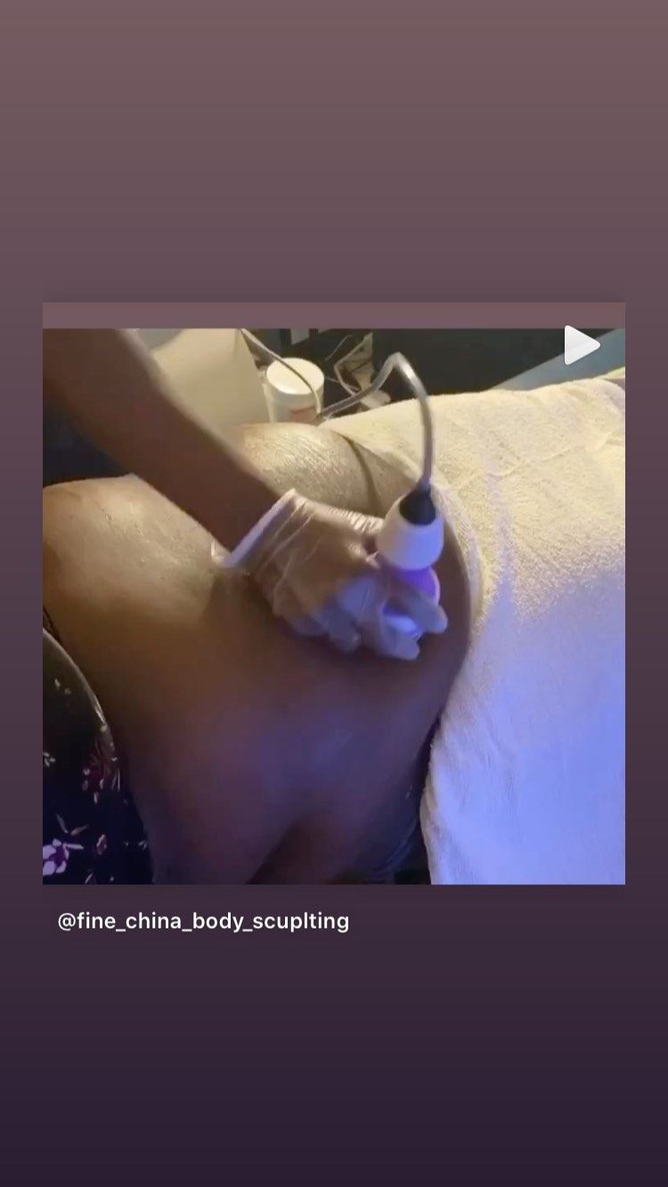Fine China Body Sculpting performing a cavitation treatment