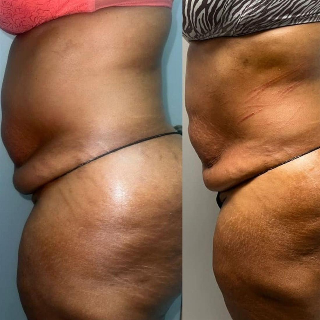 Fine China Body Sculpting website image