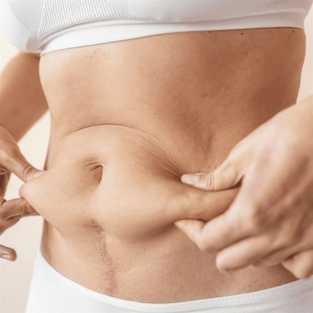Existing Fat Reduction website illustration
